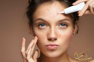 چگونه آرایشی مناسب برای پوست جوش‌دار داشته باشیم؟