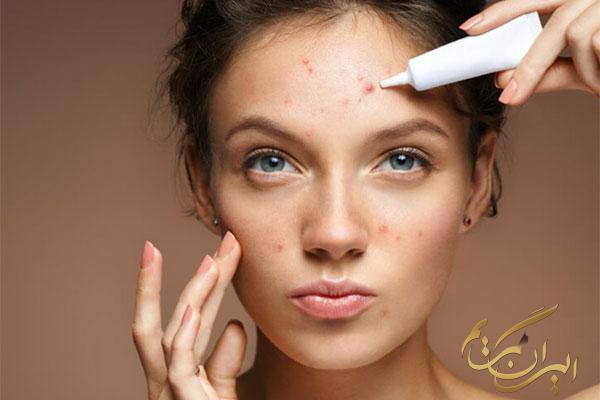 چگونه آرایشی مناسب برای پوست جوش‌دار داشته باشیم؟