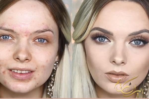 چگونه لک‌های پوست را با آرایش پنهان کنیم؟