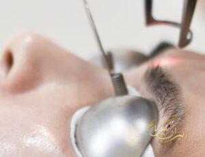 بهترین خدمات تتو ریمووال در شمال تهران | مرکز ریموو تاتو درشمال تهران