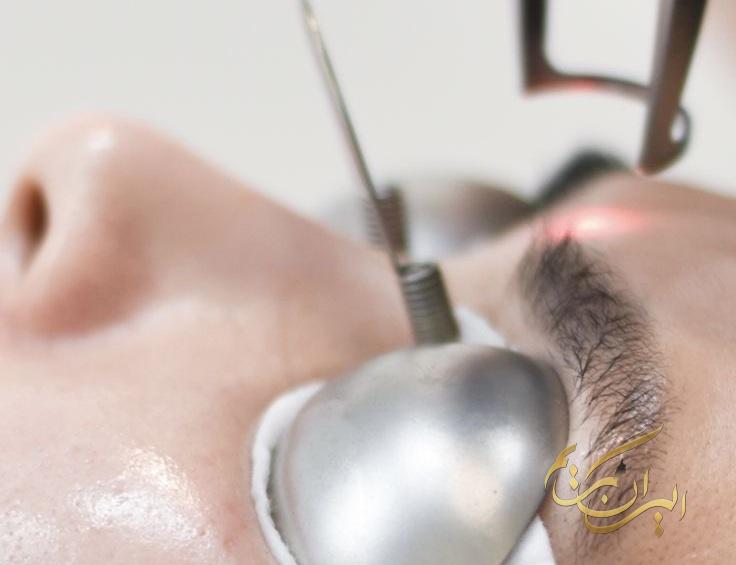 بهترین خدمات تتو ریمووال در شمال تهران | مرکز ریموو تاتو درشمال تهران